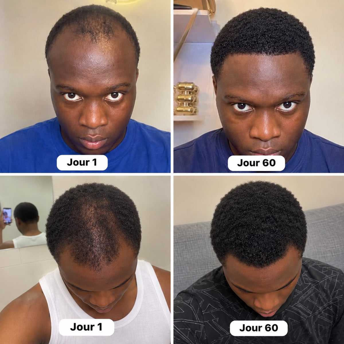Batana oil-pousse de cheveux